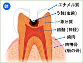 3mix法イメージ①