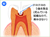 3mix法イメージ②