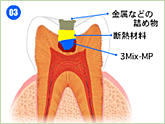 3mix法イメージ③